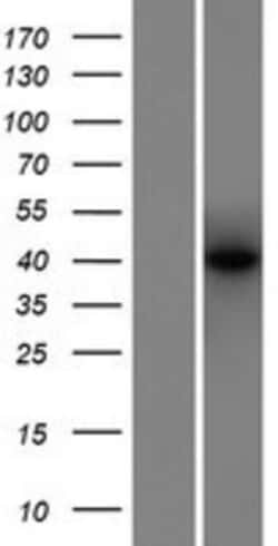Novus Biologicals™ MEF2B Overexpression Lysate
