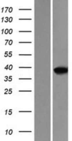 Novus Biologicals&trade;&nbsp;MEF2B Overexpression Lysate