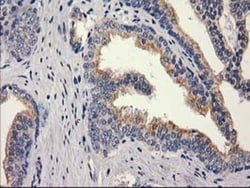 MEF2C Antibody (OTI1H5), Novus Biologicals 0.1mL; Unlabeled:Antibodies,