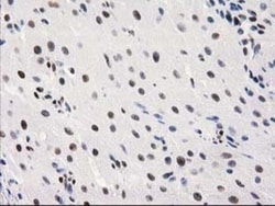 MEF2C Antibody (OTI1H5), Novus Biologicals 0.1mL; Unlabeled:Antibodies,