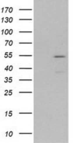 MEF2C Antibody (OTI1H5), Novus Biologicals 0.1mL; Unlabeled:Antibodies,