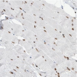 MEF2C Antibody (CL0369), Novus Biologicals 0.1mL; Unlabeled:Antibodies,