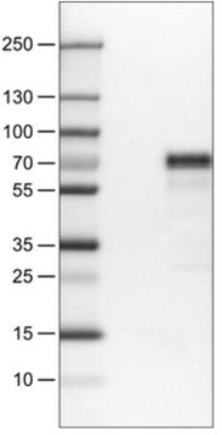 MEF2C Antibody (CL0369), Novus Biologicals 0.1mL; Unlabeled:Antibodies,