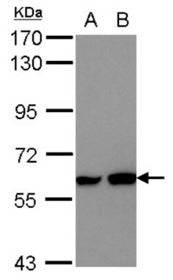 MEF2D Antibody, Novus Biologicals 0.1 mL | Buy Online | Novus Biologicals | Fisher Scientific