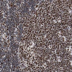 MEF2D Antibody, Novus Biologicals:Antibodies:Primary Antibodies