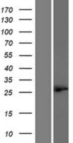 Novus Biologicals&trade;&nbsp;MEIR5 Overexpression Lysate
