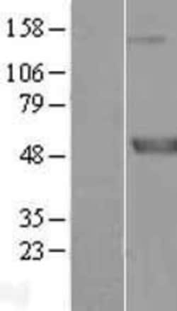 Novus Biologicals&trade;&nbsp;Meis homeobox 3 Overexpression Lysate