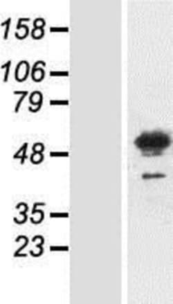 Novus Biologicals™ Meis homeobox 3 Overexpression Lysate