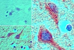 MEIS1 Antibody, Novus Biologicals:Antibodies:Primary Antibodies