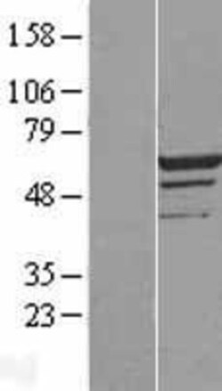 Novus Biologicals&trade;&nbsp;MEIS2 Overexpression Lysate