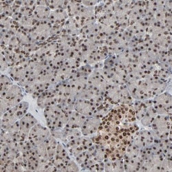 MEIS2 Antibody, Novus Biologicals 0.1mL; Unlabeled:Antibodies, Polyclonal