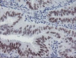 Meis homeobox 3 Antibody (OTI3E12), Novus Biologicals 0.1mL; Unlabeled:Antibodies,