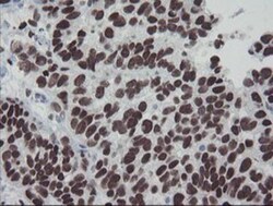 Meis homeobox 3 Antibody (OTI3E12), Novus Biologicals 0.1mL; Unlabeled:Antibodies,