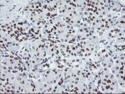 Meis homeobox 3 Antibody (OTI3E12), Novus Biologicals 0.1mL; Unlabeled:Antibodies,