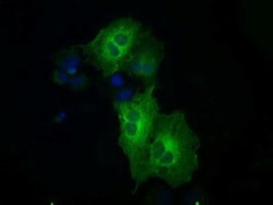 MEK1 Antibody (OTI1F5), Novus Biologicals 0.1mL; Unlabeled:Antibodies,