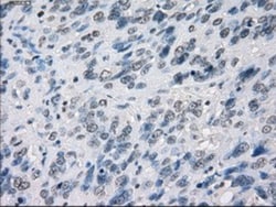 MEK1 Antibody (OTI1F5), Novus Biologicals 0.1mL; Unlabeled:Antibodies,