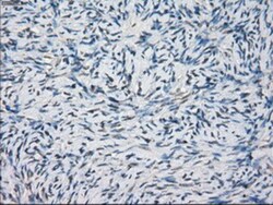 MEK1 Antibody (OTI1F5), Novus Biologicals 0.1mL; Unlabeled:Antibodies,