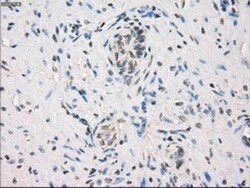 MEK1 Antibody (OTI1F5), Novus Biologicals 0.1mL; Unlabeled:Antibodies,