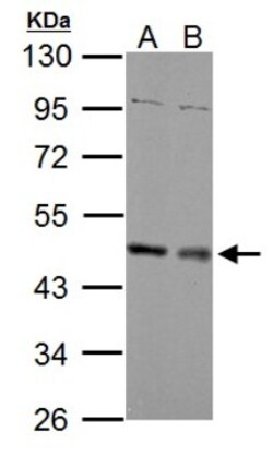 MEK1 Antibody, Novus Biologicals 0.1mL; Unlabeled:Antikroppar