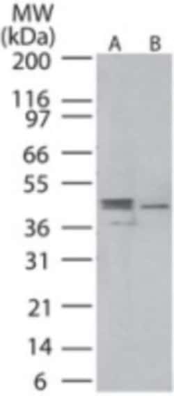 MEK1, p Ser218, p Ser222 Antibody, Novus Biologicals 0.025 mg | Buy Online | Novus Biologicals | Fisher Scientific