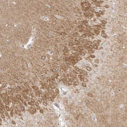 MEK1 Antibody, Novus Biologicals 25 &mu;L; Unlabeled:Antikroppar