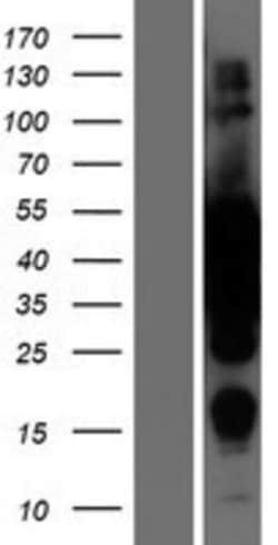Novus Biologicals&trade;&nbsp;MEK2 Overexpression Lysate