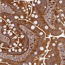 MEK2 Antibody, Novus Biologicals 0.1mL; Unlabeled:Antibodies, Polyclonal