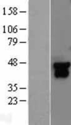 Novus Biologicals™ MKK4/MEK4 Overexpression Lysate