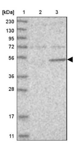 MEK5 Antibody, Novus Biologicals:Antibodies:Primary Antibodies