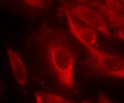 MKK6/MEK6, p Ser207 Antibody, Novus Biologicals:Antibodies:Primary Antibodies