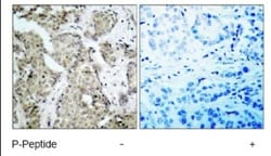MKK6/MEK6, p Ser207 Antibody, Novus Biologicals:Antibodies:Primary Antibodies