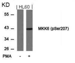 MKK6/MEK6, p Ser207 Antibody, Novus Biologicals:Antibodies:Primary Antibodies