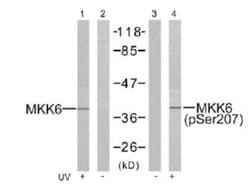MKK6/MEK6, p Ser207 Antibody, Novus Biologicals:Antibodies:Primary Antibodies