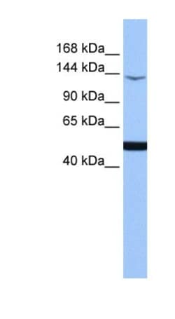 MEKK1 Antibody, Novus Biologicals 100 &mu;L | Buy Online | Novus Biologicals | Fisher Scientific