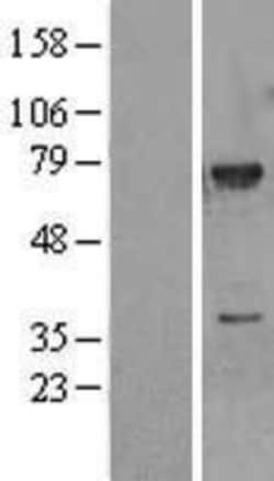 Novus Biologicals&trade;&nbsp;MEKK3 Overexpression Lysate