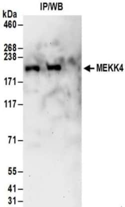 MEKK4 Antibody, Novus Biologicals 0.1mg; Unlabeled:Antibodies, Polyclonal