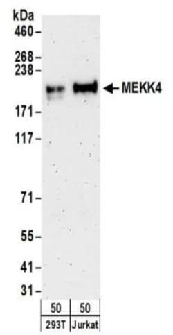 MEKK4 Antibody, Novus Biologicals 0.1mg; Unlabeled:Antibodies, Polyclonal