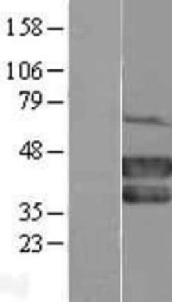 Novus Biologicals&trade;&nbsp;MEL-18 Overexpression Lysate