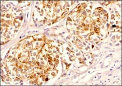 Melan-A/MART-1 Antibody (A103) - BSA Free, Novus Biologicals:Antibodies:Primary