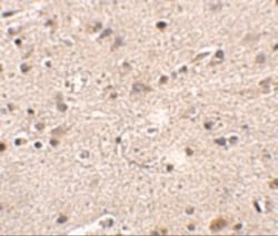 Melanocortin-4 R Antibody - BSA Free, Novus Biologicals:Antibodies:Primary