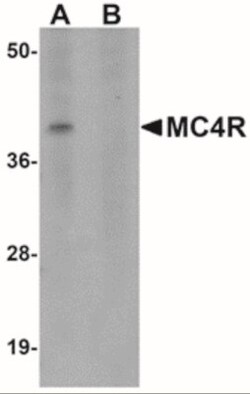 Melanocortin-4 R Antibody - BSA Free, Novus Biologicals:Antibodies:Primary
