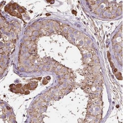 Melanoma Antigen Family B5 Antibody, Novus Biologicals:Antibodies:Primary