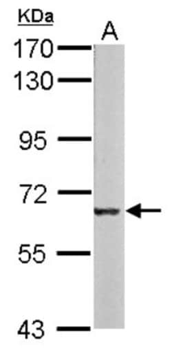 Melanophilin Antibody, Novus Biologicals 0.1mL; Unlabeled:Antibodies, Polyclonal