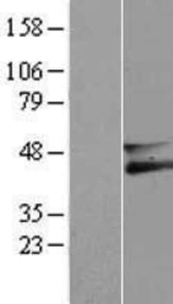 Novus Biologicals&trade;&nbsp;Membralin Overexpression Lysate