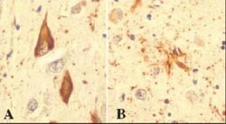 Novus Biologicals™ Memory Loss Antibody Pack