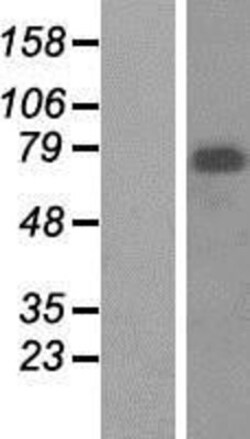 Novus Biologicals&trade;&nbsp;Menin Overexpression Lysate