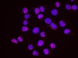 Menin Antibody, Novus Biologicals 0.1mg; Unlabeled:Antibodies, Polyclonal