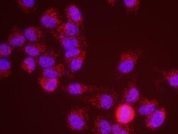 Menin Antibody, Novus Biologicals 0.1mg; Unlabeled:Antibodies, Polyclonal