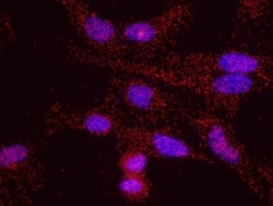 Menin Antibody, Novus Biologicals 0.1mg; Unlabeled:Antibodies, Polyclonal