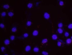 Menin Antibody, Novus Biologicals 0.1mg; Unlabeled:Antibodies, Polyclonal